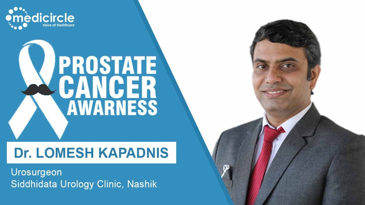 Early signs of Prostrate Cancer and its treatments - Medicircle