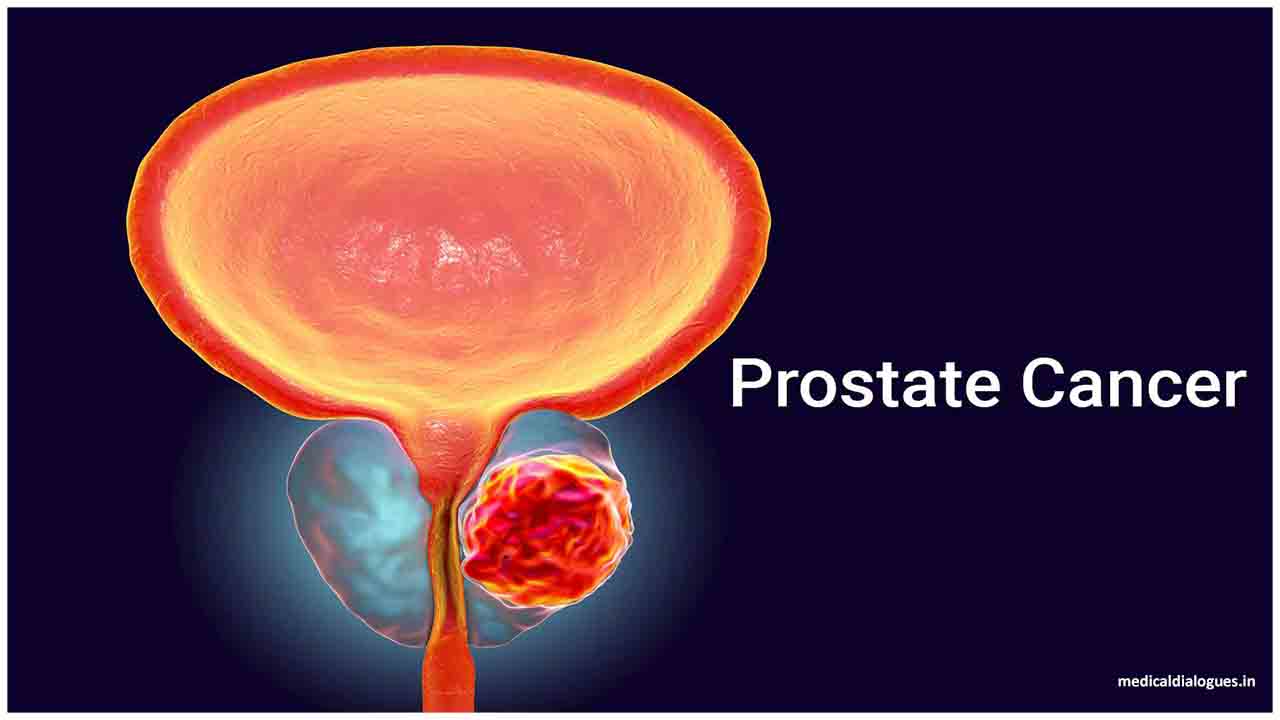 Prostate cancer awareness month