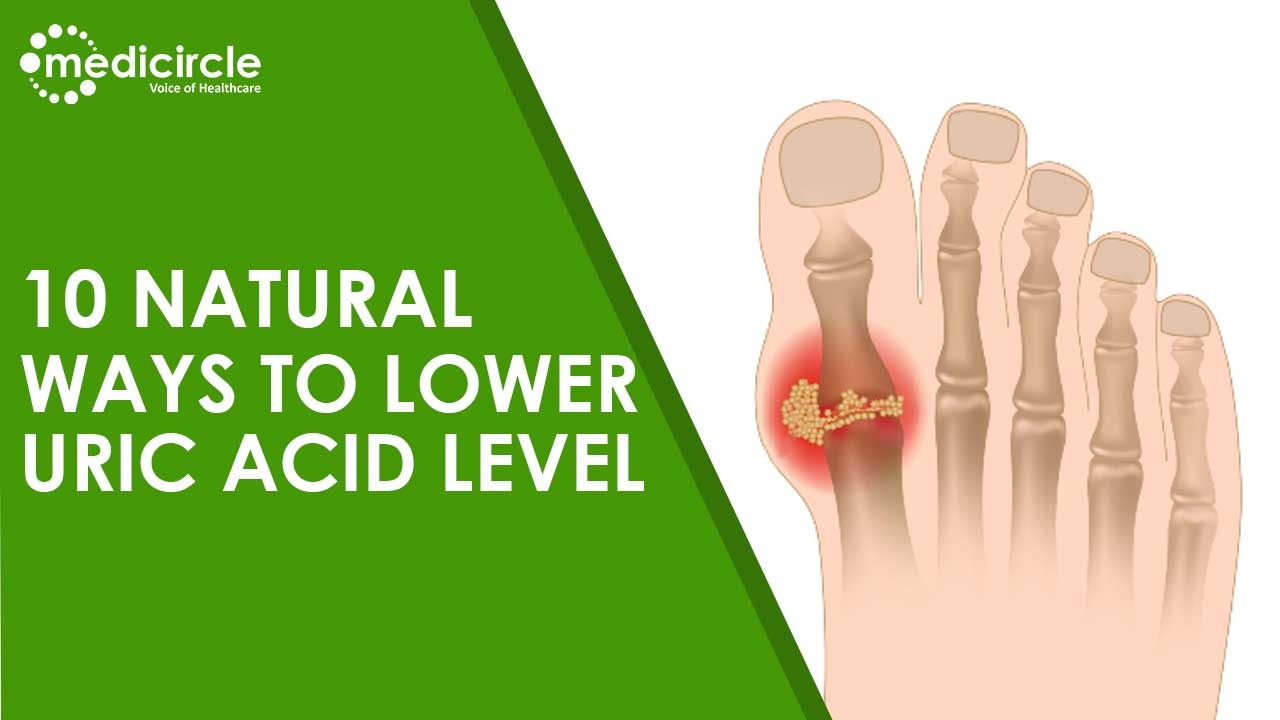 10 Natural Ways To Lower Uric Acid Level