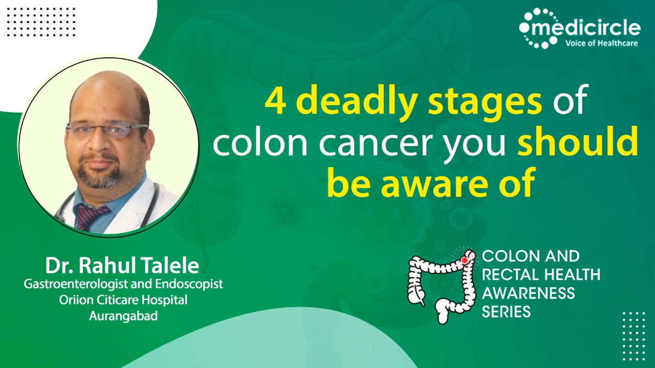 causes-signs-and-symptoms-of-colon-cancer