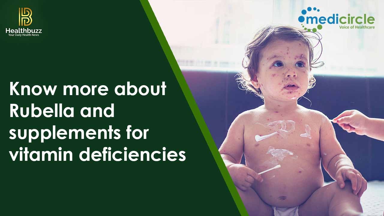 Know more about Rubella and supplements for vitamin deficiencies