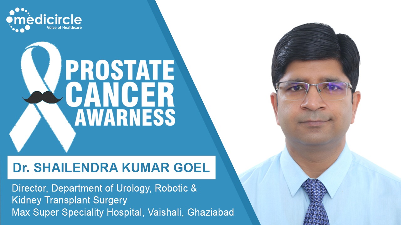 Prostate cancer and life expectancy - Medicircle